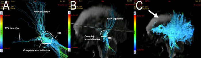 cerebro-medio-contraste-resonancia-magnetica-rayos-x-quito-ecuador-solca-cuenca-guayaquil